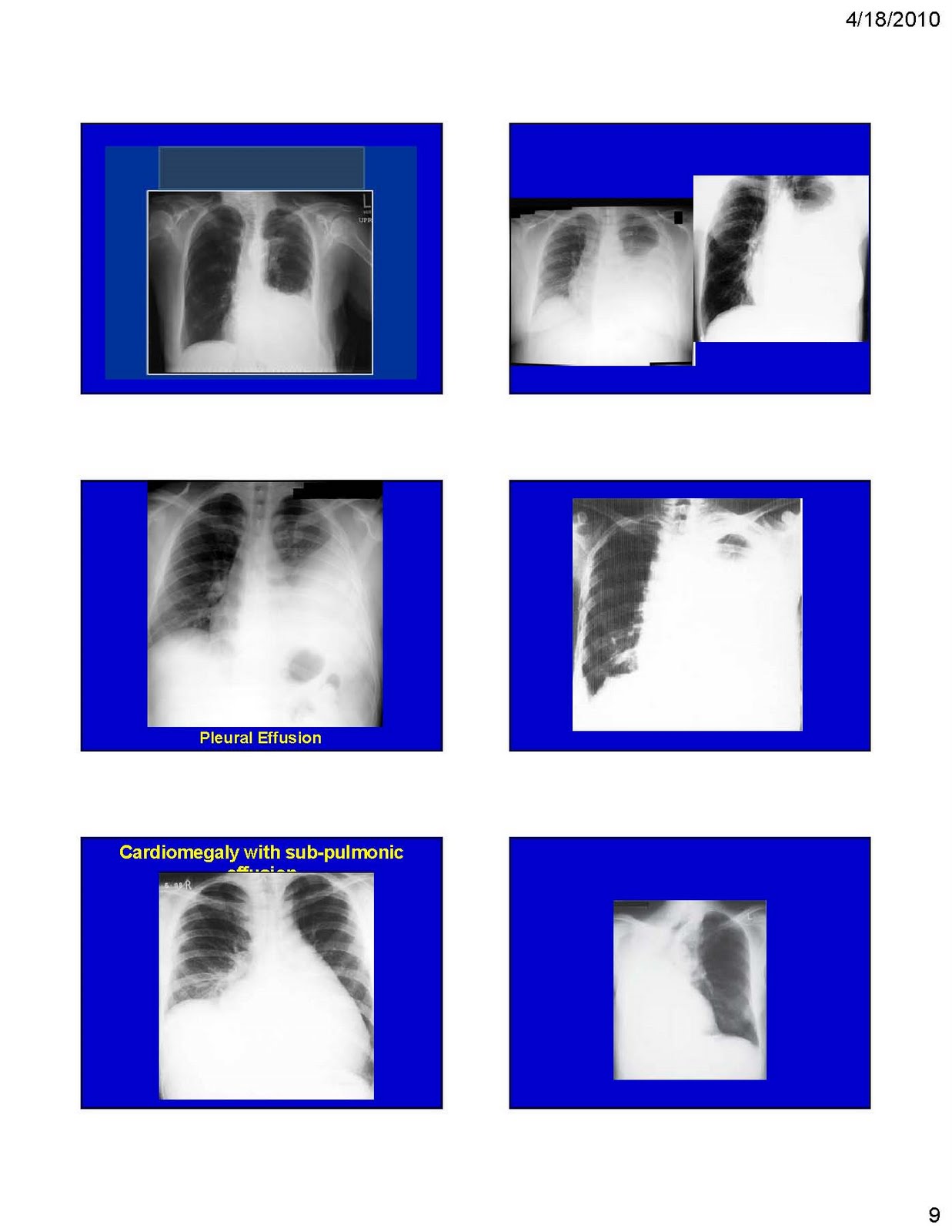 Respiratory Critical Care and Sleep Medicine CHEST XRAY